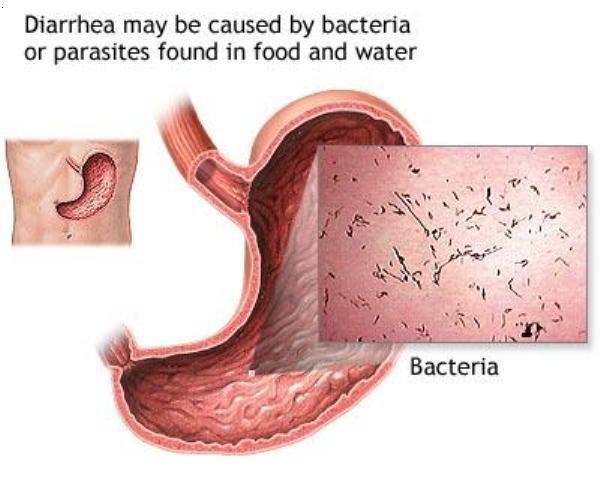 diarrhea1